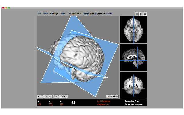 Dicom Medical Image Viewer from Chrome web store to be run with OffiDocs Chromium online Dicom Medical Image Viewer from Chrome web store to be run with OffiDocs Chromium online